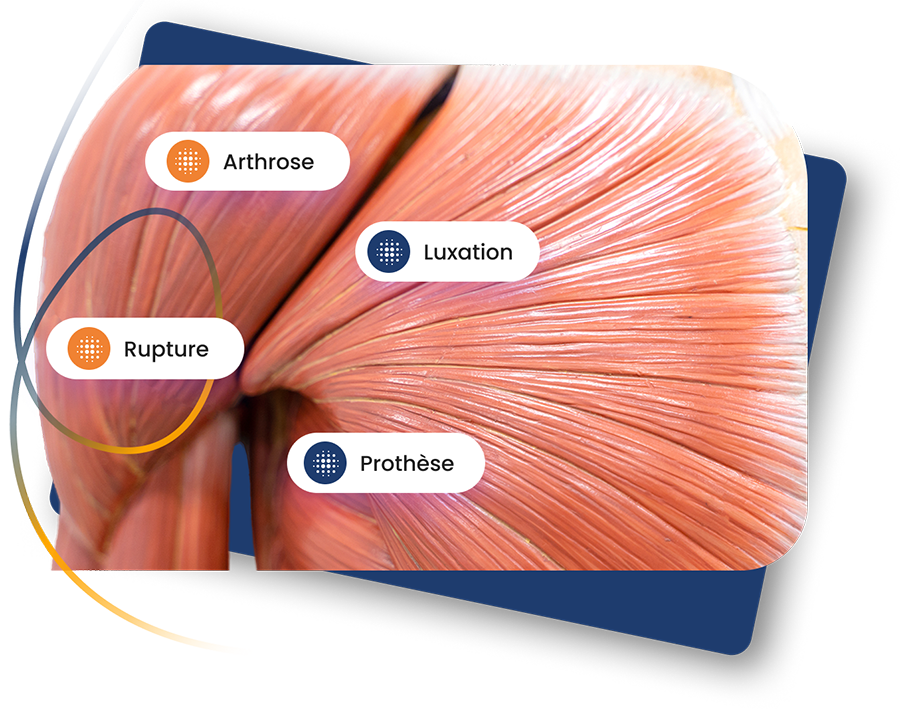 Réseau de Praticiens Spécialiste de l’Épaule